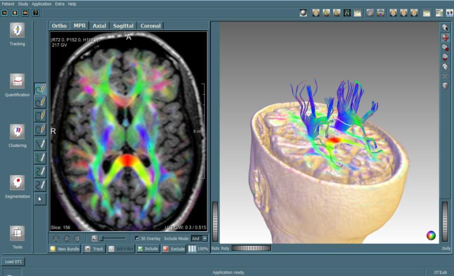 provide functionality for preprocessing DTI data, or performing motion correction and filtering on fmri datasets. 3.