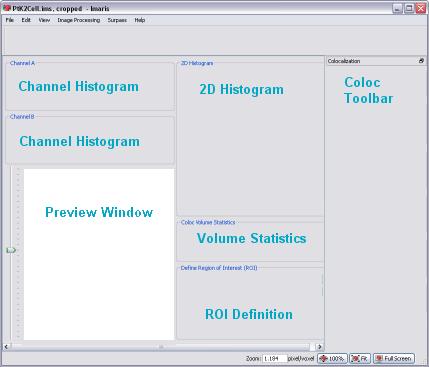 Channel Histogram (channel A, channel B). This area allows the selection of the two channels for the colocalization analysis. Preview Window.