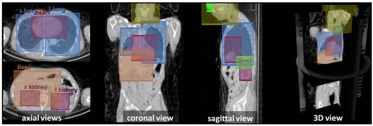 Machine learning in medical imaging: Anatomy localization with random forest classification Criminisi et al.