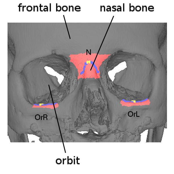 6 S. Van Cauter et al. (a) Anterior view: landmarks OrR, OrL and N. (b) Superior view: landmarks CAL, CAR, CPL, CPR and SI. (c) Paramedian sagittal view: landmarks SS, SI and S. Figure 3.