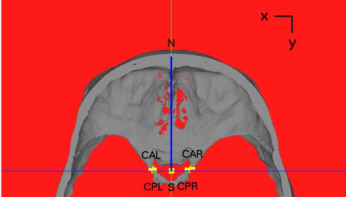 The reference system used to orientate the skull (x, transversal axis; y, sagittal axis; z, longitudinal axis). orientation requisites of Table 2 are evaluated.