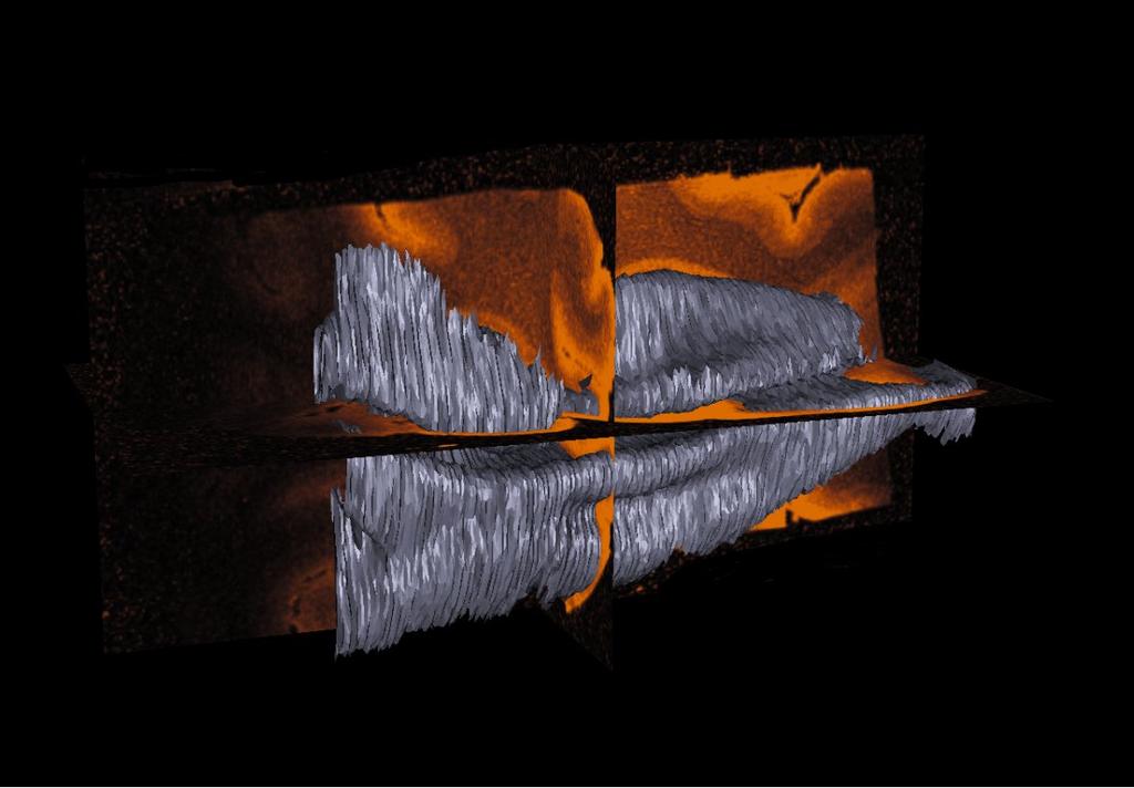 Figure 2: Reconstruction of the striate surface shown embedded in three orthogonal slices from the MR data.