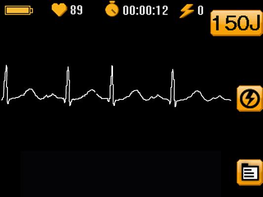 Entering Manual Mode (continued) When Manual Mode is entered, the main screen automatically switches to ECG view and text prompts provide instruction.