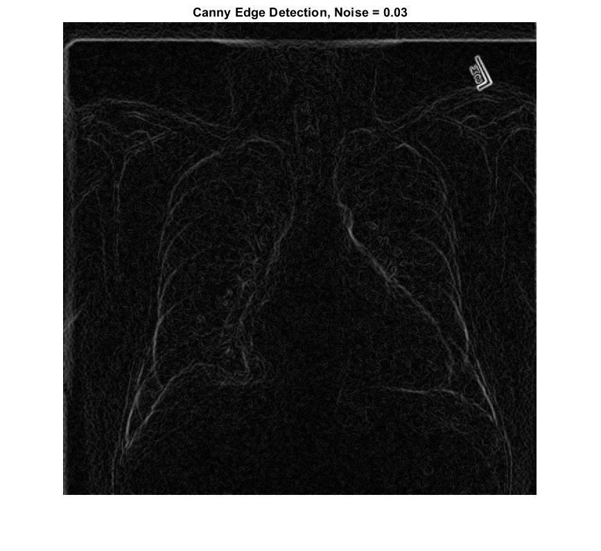 Results Canny Edge Detection Figure 7: