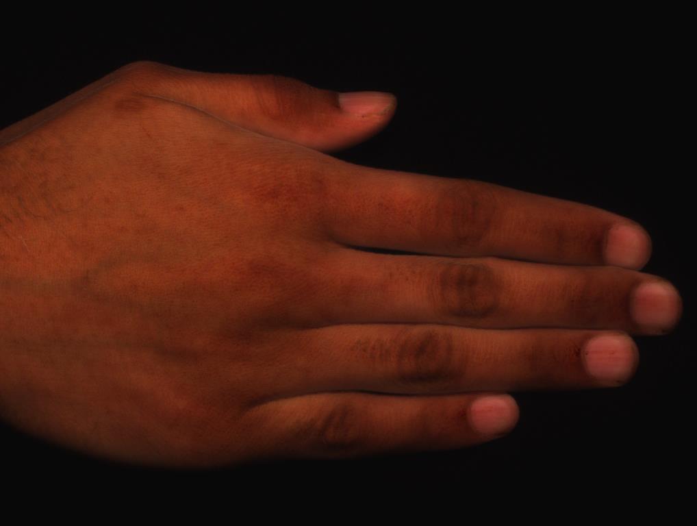 Hand Skin: Hanrahan and Krueger 93, Uchida 96, Haro 01, Jensen