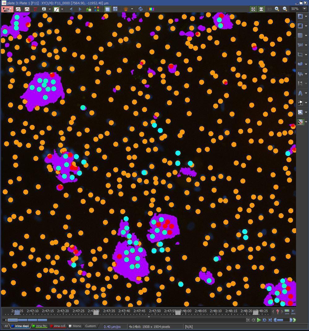 Analysis methods: Simple: cell count (nuclei), intensity-based segmentation Complex: