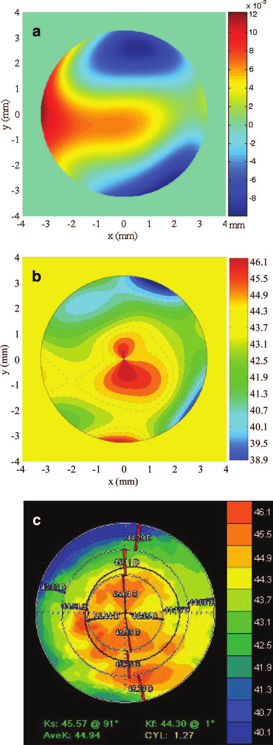 07; (c) meridional curvature from the Tomey TMS-4 topographer with data: 44.76 0.47 129, and AveK 44.53 (Min K 44.26). The parameters for the eye-pupil from the HT topographer are: diameter D 4.