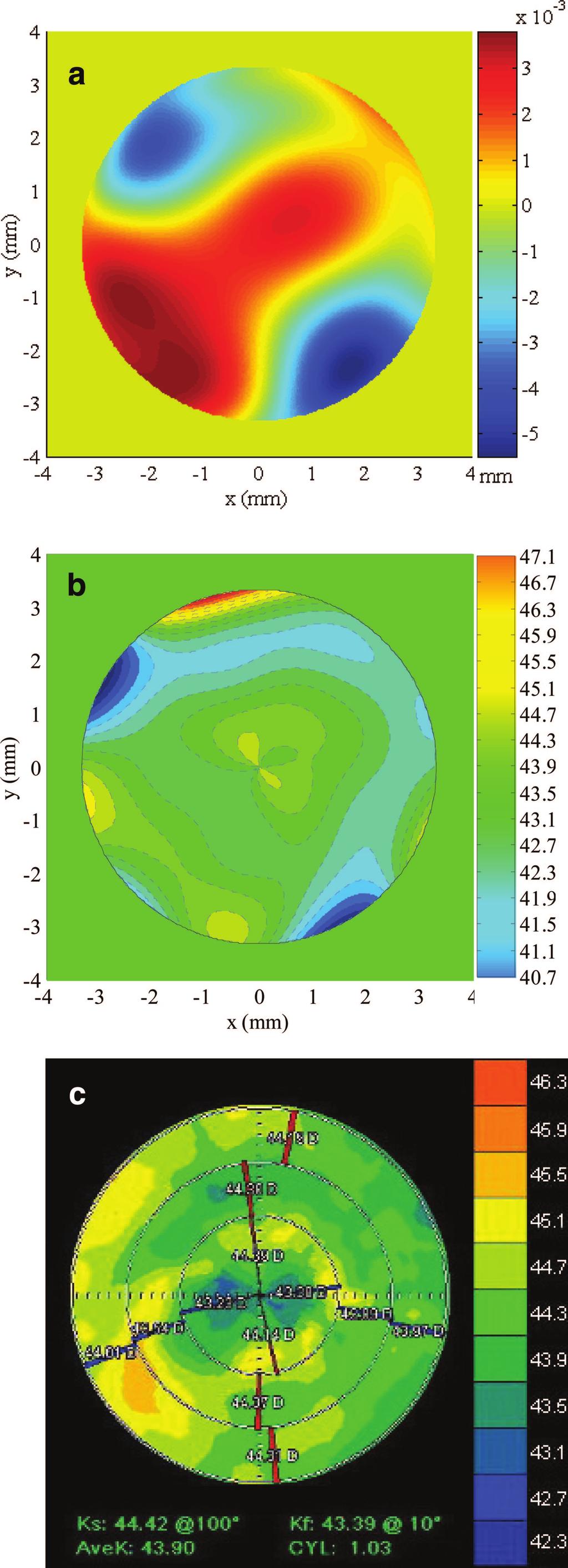 378 Corneal Topographer Based on the Hartmann Test Mejía and Galeano FIGURE 5. A toric surface of PMMA with nominal values Rmin 7.62 0.02 mm 