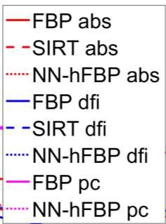 images, the NN-FBP performs better than FBP and SIRT in terms of the RMSE and the FSIM, and slightly worse than the FBP in terms of the MAD.