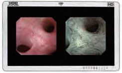 Video Uretero-Renoscopes, flexible Overview n Video Uretero-Renoscopes, flexible Video