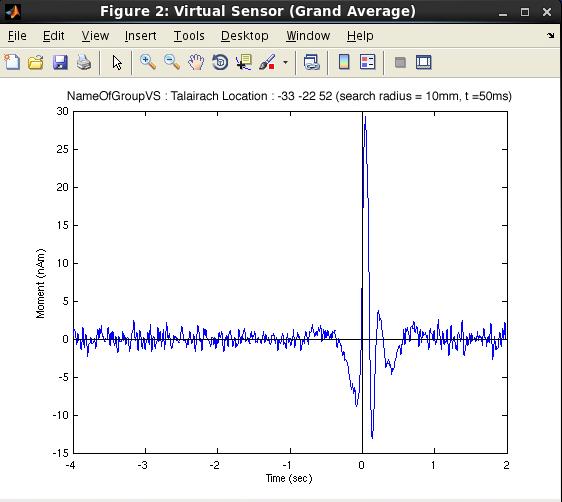 Plot VS button then plots the averaged virtual sensor amplitude over time (see figure below).