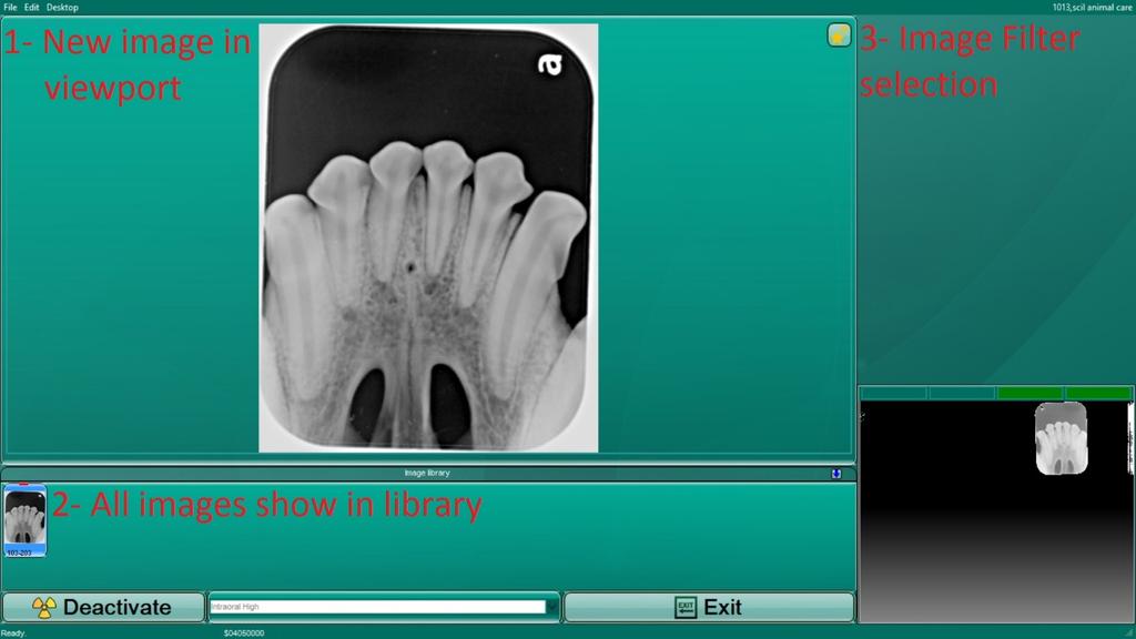 Clicking on a selected tooth (highlighted in grey) will deselect it.