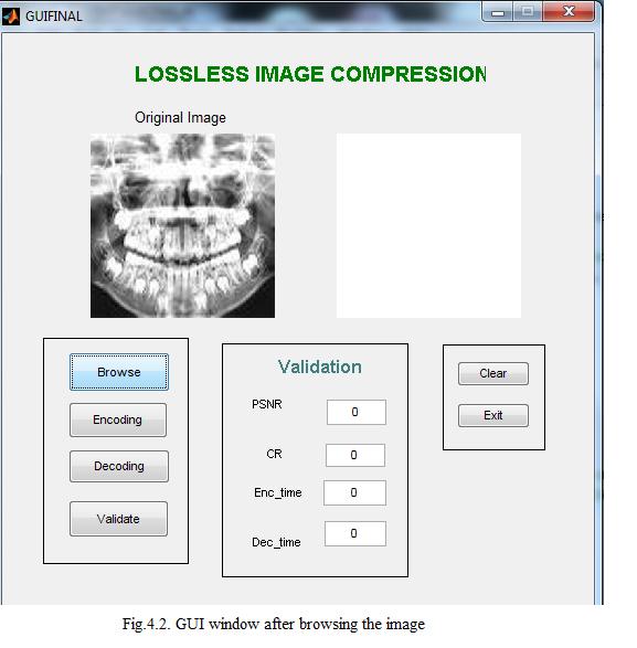 When we browse for a DICOM image or any other image, the chosen image will get displayed in the GUI, as shown in the gure 4.2.