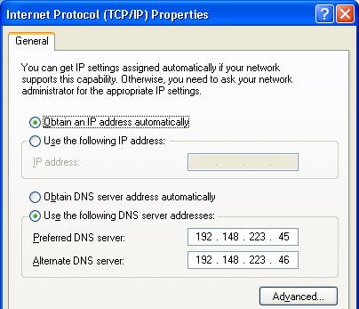 Another Properties window will appear. Leave the top option on Obtain an IP address automatically.