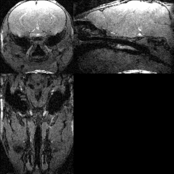 75 Figure 4.1: MRI volume:(a) Coronal view, (b) Sagittal view, (c) Axial View 4.1.2 Blockface and Histological Images BlockFace Images The blockface images are produced by a series of procedures.