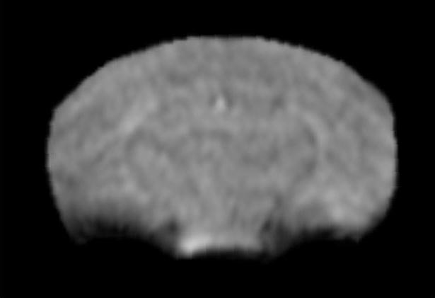 Warped Image 1 Brain MRI