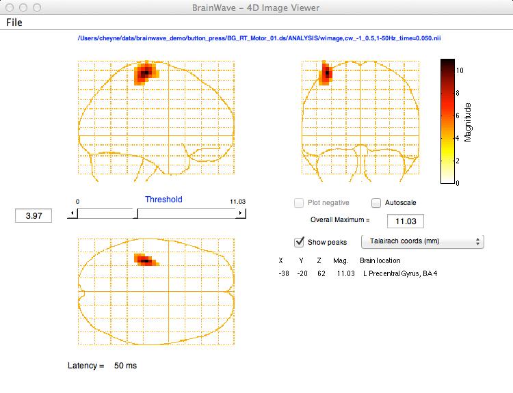 BrainWave: Template Normalization and Group Analysis SPM and