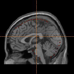 BrainWave: Template Normalization and Group Analysis What if I don t have an MRI? Step 1.