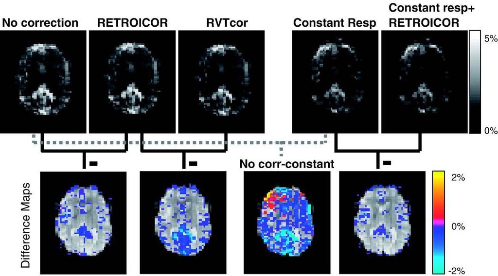 Respiration Modulates BOLD Contrast at Rest Birn et al., Neuroimage (2006) Cardiovascular and Respiratory Artifacts Poncelet et al.