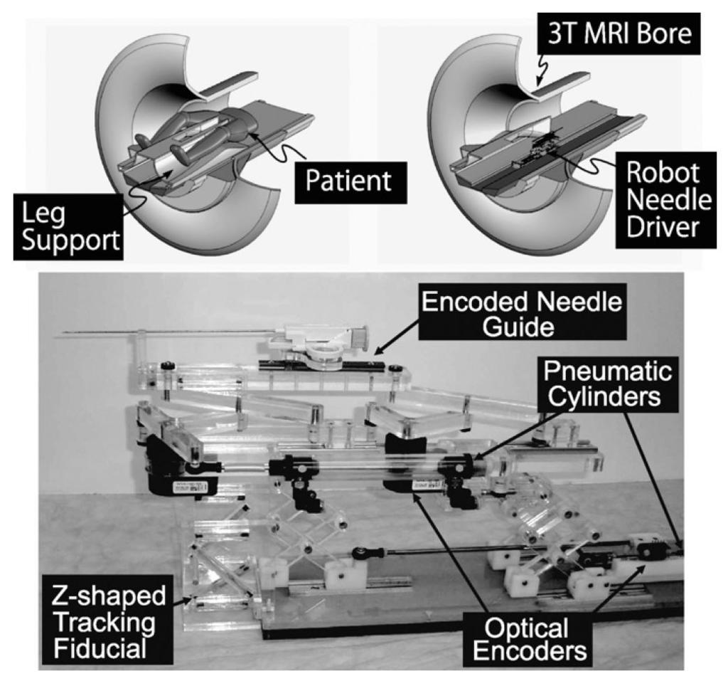 Tokuda et al. Page 10 Fig. 1. A robot for transperineal prostate biopsy and treatment [16].