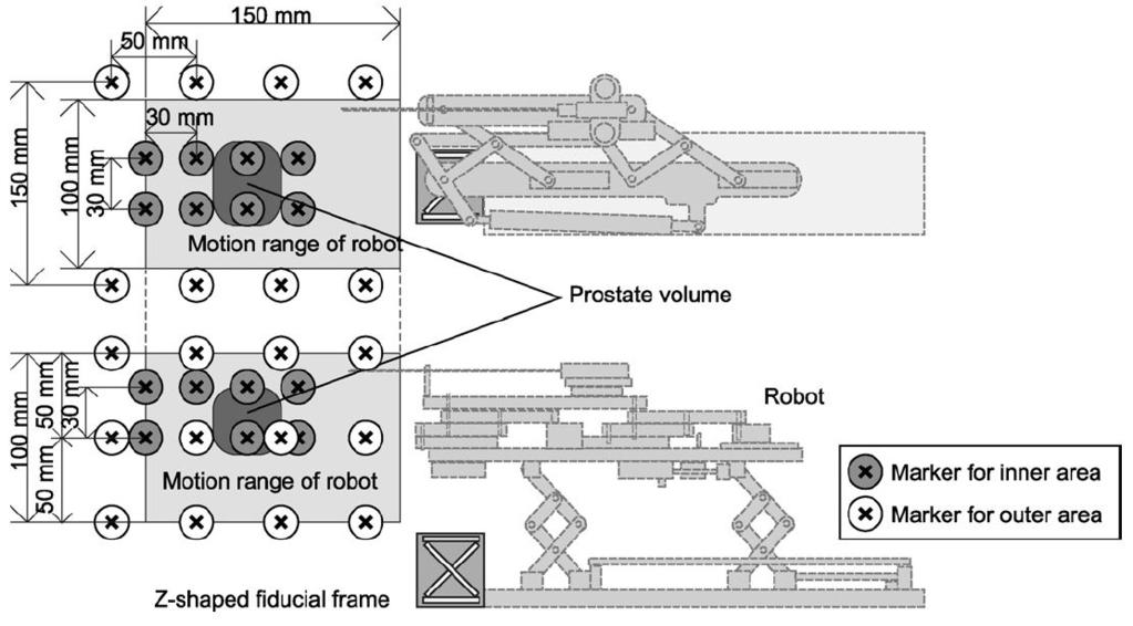 Tokuda et al. Page 15 Fig. 6. The physical relationship among robot, Z-frame, targets, range of motion, and markers is shown. The Z-frame is attached.