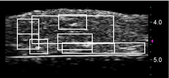 Analysis of Bovine Liver Images cm Superimposed
