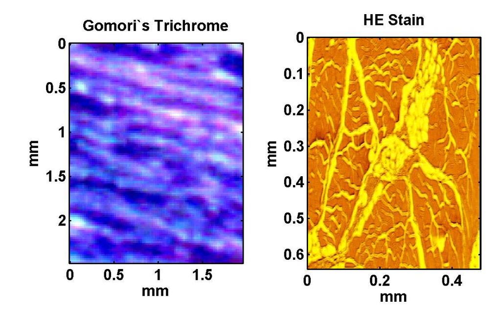 Histological Studies to Determine Distributions of Scatterer Types Turkey breast tissue Pork rib muscle Pixel size is about 20 µm, the scatterer size assumed in our model of CBE.