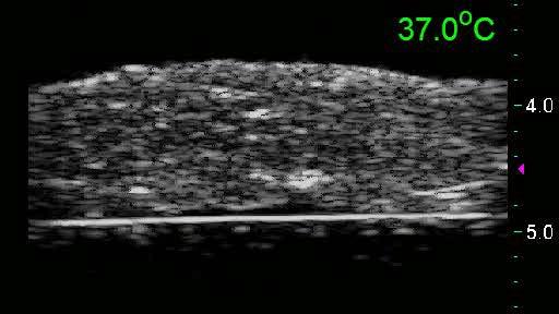 Ultrasonic Image of Bovine Liver cm click on image for mpg movie Focal zone at arrow