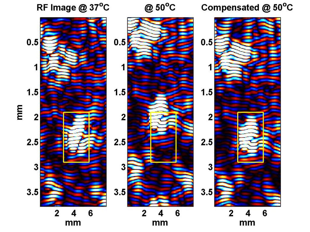 Apparent Motion in RF Images ¾ Radio-frequency images of bovine liver at 37 (left) and 50oC (center & right) ¾ Features in the fixed, highlighted region appear to have moved both