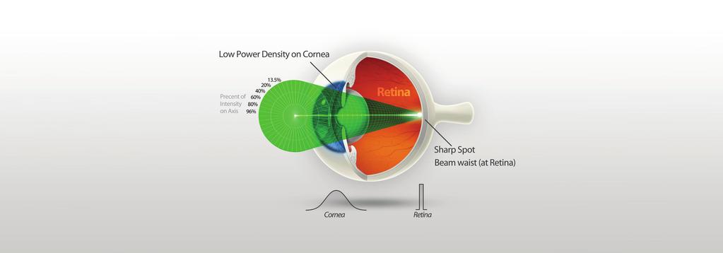 SureSpot Optics Sharply defined and evenly distributed power on the retina; Safe & low-power density at the cornea and the lens Defocus Optics Lumenis Patented SureSpot TM Optics Parfocal Optics The
