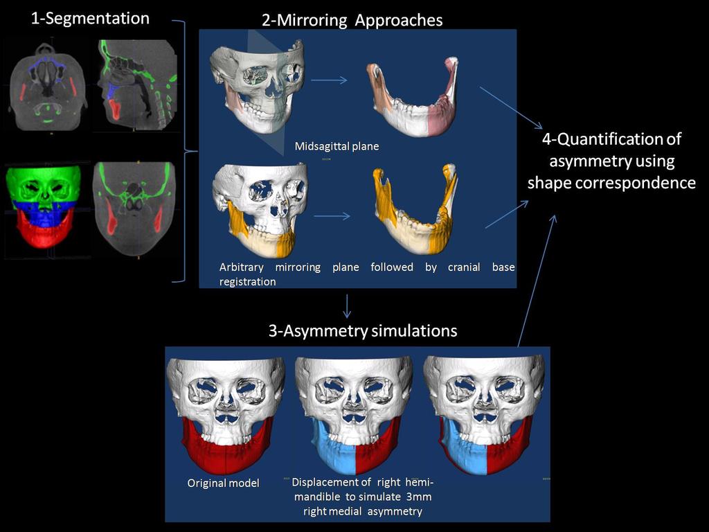 Figure 7. Validation of asymmetry quantification methods: (1) Cone beam CT s are taken for each patient and segmentation involves delineation of the anatomical areas of interest.