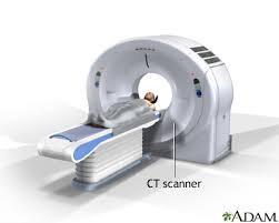 Abstract CT scan imagings is one of the fastest and accurate methods for examining heart and plays a vital role in detection of size of the blocks and identify its precise region in heart.