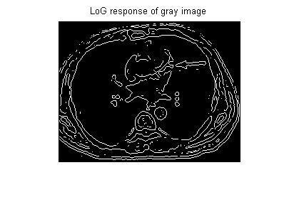 16 is the final resultant obtained after applying fuzzy logic and the detected blocks are highlited along with the bones. 9. CONCLUSION Fig.13: Log responce of gray The Fig.