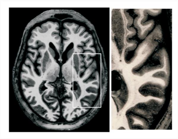 Figure 1. In the brain, the gray matter has substantially more blood vessels and capillaries than white matter.