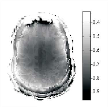 inside the human head. Illustration courtesy of Drs. Shizhe Li, C.M. Collins, Q.X. Yang, and M.B. Smith. Figure 4.