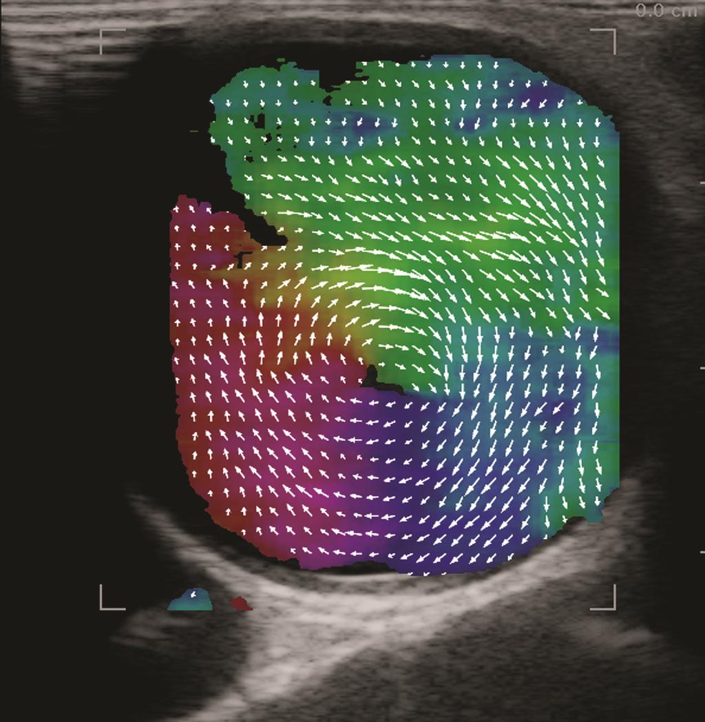 Front-line research in Ultrasound CFU research Part 2: Fast Vector Flow Imaging, Pressure Gradients, Super Resolution and