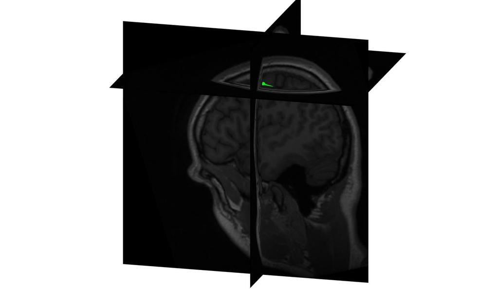 Model the brain activity with a