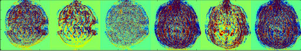 CS7415 Enhanced multi-contrast MRI reconstruction with Deep Learning & NVIDIA GPUs residual