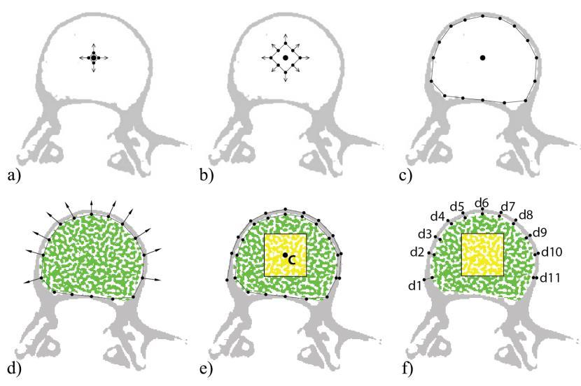 When a point reaches the cortical bone it stops moving, the algorithm stops when all of the points stop moving (Fig. 2c).