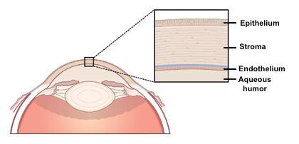 1. Introduction Lein Applied Diagnostics device measures the thickness of the central cornea, that is, the distance between the epithelium and endothelium surfaces Background Several techniques exist