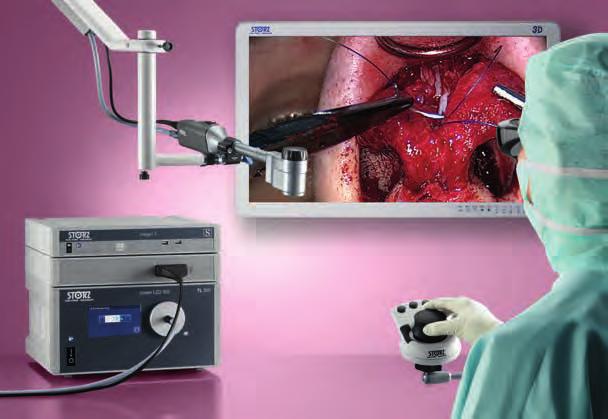 VITOM 3D 3D Visualization for Otorhinolaryngology and Open Surgery The VITOM 3D system provides many surgical disciplines with a revolutionary solution for the visualization of microsurgical and open