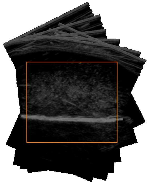Digital Polaris optical tracker scanning a phantom.
