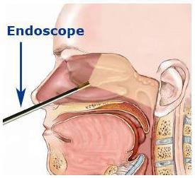 Introduction Functional endoscopic sinus surgery (FESS) is a routine operation performed by an otolaryngologist Between 200,000 and 600,000 endoscopic interventions per year in the USA [1][2][3]