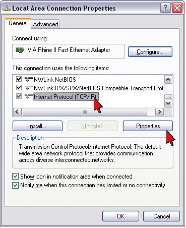 4) Select Obtain an IP address automatically and