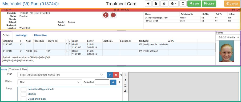 Treatment Card Pre-requisite: Before you can start charting treatment notes for your patients, treatment card templates with the information that your office wants to chart in Silverlight; Setup