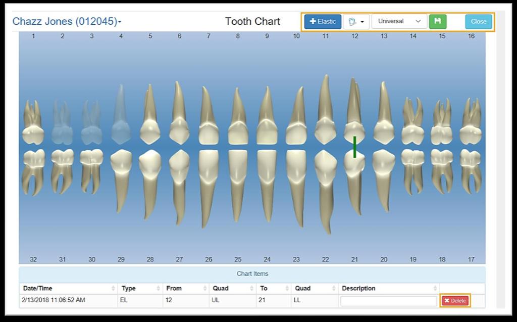 Using the options at the top of the Tooth Chart, users can: Add horizontal and