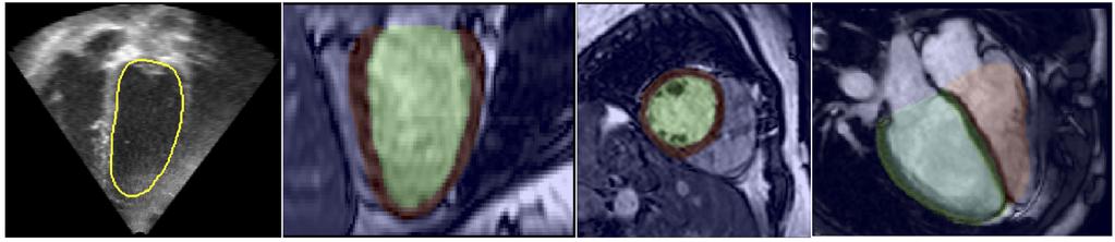 2.1. Cardiac MR and Ultrasound Image Segmentation 19 requirements).