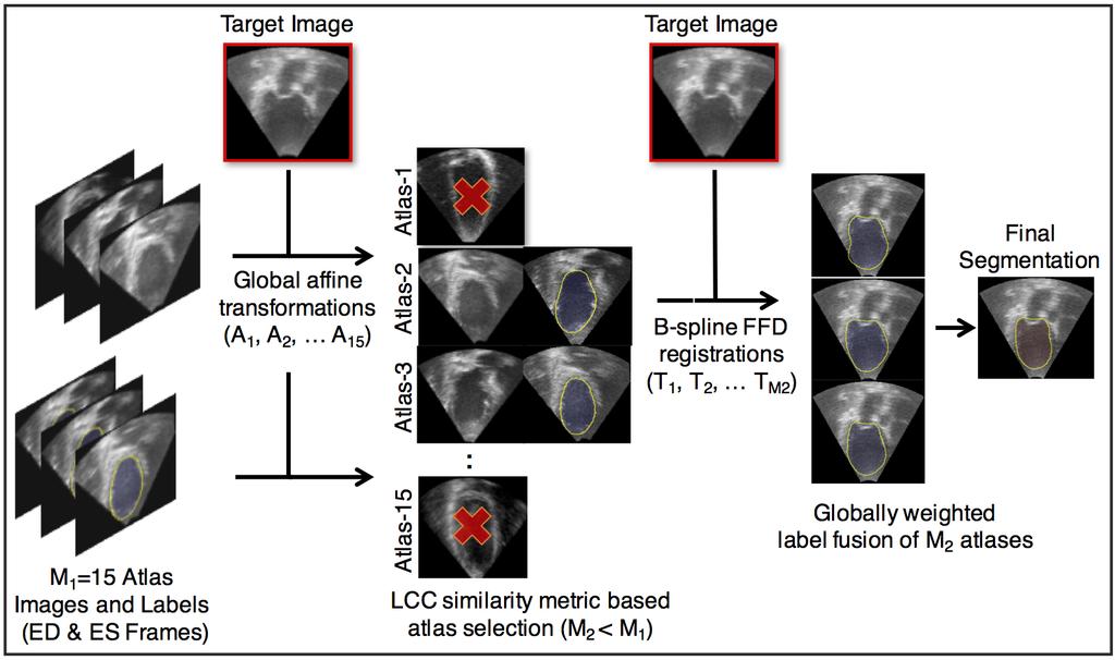 22 Chapter 2. Review of Machine Learning Methods in Cardiac Image Analysis Figure 2.3: Diagram of a standard multi-atlas label fusion segmentation method.