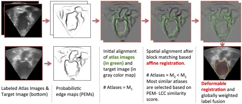 3.4. Multi-Atlas Segmentation of Cardiac Ultrasound Images with PEMs 67 Figure 3.8: A block diagram of the proposed multi-atlas segmentation framework for 3D-US cardiac images.