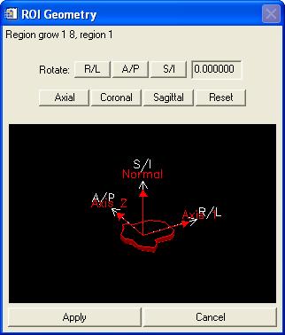 Editing ROI geometry: The orientation of the currently selected ROI region can be manipulated by clicking the Geometry button in the ROI list window.